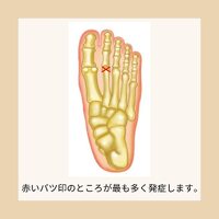 画像308