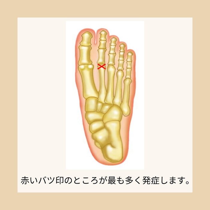 画像308